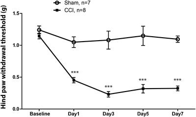 Morphological and Physiological Plasticity of Spinal Lamina II GABA Neurons Is Induced by Sciatic Nerve Chronic Constriction Injury in Mice